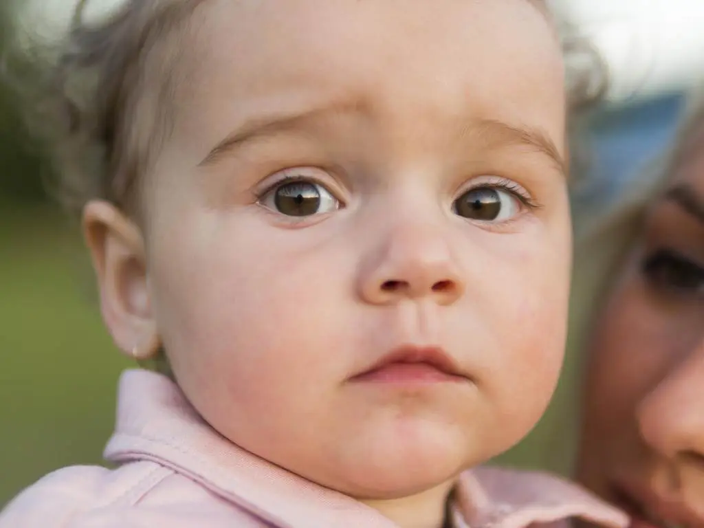 Dudak Damak Yarıkları - Prof. Dr. Hakan Ağır